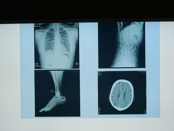 Good price ฟิล์มกันน้ำทางการแพทย์ Konida X Ray สำหรับเครื่องพิมพ์ Agfa ออนไลน์