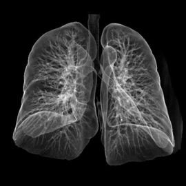 Good price เลเซอร์ความคมชัดสูงทางการแพทย์ X-ray ฟิล์มเลเซอร์ Konida สำหรับ CT / DR ออนไลน์