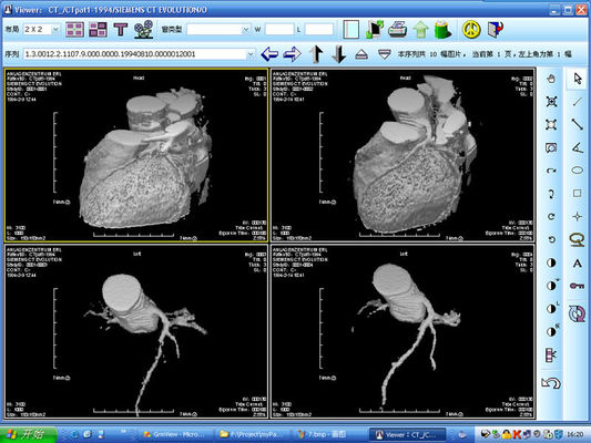 ราคาดี เครื่องสแกนซิลเวอร์ X-ray สำหรับการวิเคราะห์ภาพด้วยเลเซอร์สำหรับ KND-DRYTEC 4000 ออนไลน์