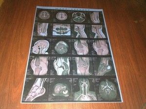 Good price ฟิล์มเอ็กซ์เรย์ทางการแพทย์หมอกต่ำความคมชัดสูงฟิล์มแห้ง X-ray ของ Konida ออนไลน์