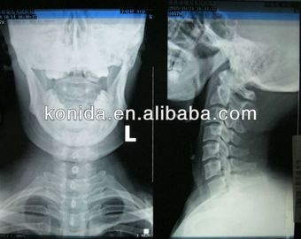 Good price ภาพรังสีวินิจฉัยทางการแพทย์ความคมชัดสูง, ฟิล์มแห้ง AGFA X Ray ออนไลน์
