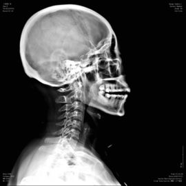 Good price ฟิล์มโปร่งใส Xray ทางการแพทย์ของ Konida ความหนาแน่นสูง KND-F สำหรับฟูจิ 3000, 2000, 1,000 ออนไลน์