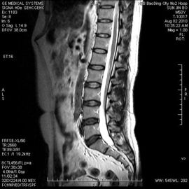Good price ฟิล์มกันความชื้นแบบแข็ง X-ray แห้งแพทย์ 8in x 10in สำหรับเครื่องพิมพ์ความร้อน ออนไลน์