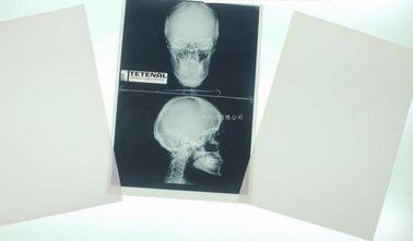 Good price 11 x 14 Laser Medical Diagnostic Imaging สำหรับเครื่องพิมพ์เลเซอร์ Konida ออนไลน์
