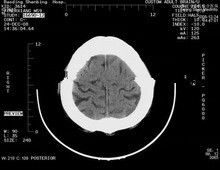 ราคาดี ฟิล์มเอ็กซ์เรย์กระดาษทางการแพทย์ป้องกันรอยขีดข่วน 8 x 10 สำหรับเครื่องพิมพ์เลเซอร์ Konida ออนไลน์
