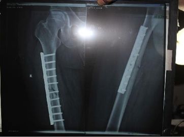 ราคาดี ฟิล์ม Xray กระดาษทางการแพทย์ที่เป็นมิตรต่อสิ่งแวดล้อมสำหรับเครื่องพิมพ์เลเซอร์ KND DRYTEC 3000 ออนไลน์