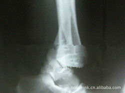 Good price กระดาษเลเซอร์สีขาว X-Ray Medical Imaging 8in x 10in Waterproof ออนไลน์