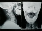 Good price เครื่องถ่ายเอกสารดิจิตอล X-ray ของ Konida Medical Dry Imaging สำหรับเครื่องพิมพ์ Fuji / Agfa ออนไลน์