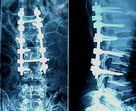 Good price ฟิล์มเอ็กซ์เรย์ของ AGFA Medical X ray ขนาด 10 นิ้ว x 12 นิ้วความคมชัดสูง ออนไลน์