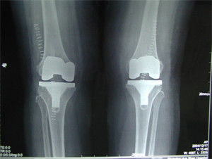Good price 14 * 17 นิ้ว agfa ที่มีคุณภาพสูงแห้งดิจิตอล X-ray ฟิล์ม ออนไลน์