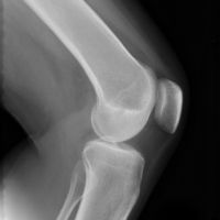 Good price ฟิล์ม Xray ความคมชัดสูง, ฟิล์มเอ็กซ์เรย์ถ่ายภาพทางการแพทย์สำหรับเครื่องพิมพ์ fuji drypix 2000 ออนไลน์