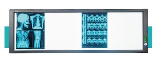 ราคาดี กล่องดูไฟฟ้า LED สูตรการแพทย์ที่สว่างมาก ออนไลน์