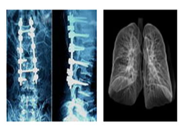 Good price ฟิล์มเอ็กซ์เรย์แพทย์รังสีเอกซ์ชาร์ป, ฟิล์มถ่ายภาพดิจิตอล DR แห้ง Mri Dr Ct ออนไลน์