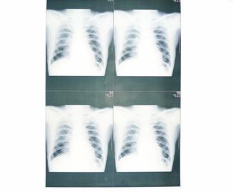 Good price ฟิล์มสีขาวฐานแพทย์ X-ray กระดาษกันความชื้นสำหรับเครื่องพิมพ์เลเซอร์ Sony / EPSON ออนไลน์