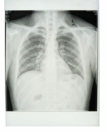 Good price ที่กำหนดเอง 25cm * 30cm สีขาวฐาน Xray กระดาษฟิล์มแพทย์ด้วยวัสดุ PET ออนไลน์