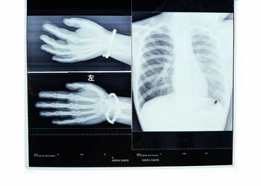 Good price ฟิล์มชนิดแห้งความต้านทานความร้อนความคมชัดสูงของ Konida Medical ออนไลน์