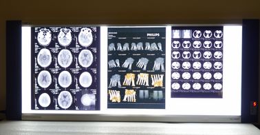 Good price Bright Medical X Ray เครื่องพิมพ์ความร้อนแบบแห้งฟิล์มเลเซอร์สีน้ำเงินฐาน ออนไลน์