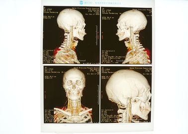 ราคาดี ฟิล์มเอ็กซ์เรย์ทางการแพทย์ความหนาแน่นสูงสีน้ำเงินสำหรับเครื่องพิมพ์เลเซอร์ Konida ออนไลน์