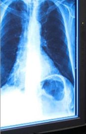 Good price ฟิล์ม X-ray Dry Medical Imaging ฟิล์ม 11in x 17in สำหรับเครื่องพิมพ์ความร้อน ออนไลน์