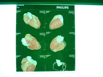 Good price ฟิล์มแห้งแพทย์ดิจิตอล X Ray, Dt2b / Dt1b Agfa ฟิล์มถ่ายภาพทางการแพทย์แห้ง ออนไลน์