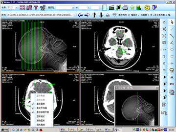 8 x 10 นิ้วกระดาษทางการแพทย์เลเซอร์ X-ray การวินิจฉัยการถ่ายภาพสำหรับ KND-DRYTEC 4000