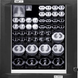 ฟิล์มเอ็กซ์เรย์แพทย์ฐานสีขาวสวมใส่ได้, ฟิล์มกระดาษ X-ray ทางการแพทย์เพื่อการถ่ายภาพ
