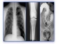 Good price Holographic Medical Imaging Film, Thermal Printer, PET X Ray Film ออนไลน์