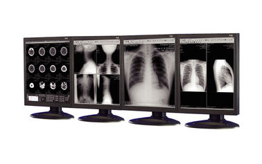 Anti-Reflective Medical Grade Display ที่ใช้ในอุปกรณ์เกี่ยวกับการถ่ายภาพทางการแพทย์