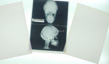 11 x 14 Laser Medical Diagnostic Imaging สำหรับเครื่องพิมพ์เลเซอร์ Konida