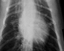 Good price กระดาษ Xray หมอกต่ำ 11 x 14 สำหรับเครื่องพิมพ์เลเซอร์ทางการแพทย์ KND-K ออนไลน์