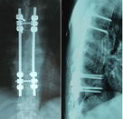 Good price X Ray Dry Medical Imaging Film สีน้ำเงิน 8 x 10 นิ้วสำหรับ Agfa / Fuji ออนไลน์