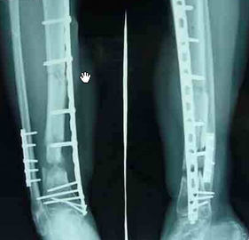Good price แพทย์เลเซอร์กระดาษเครื่องพิมพ์ X-ray วินิจฉัยการถ่ายภาพสำหรับโรงพยาบาล ออนไลน์