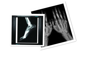 Hosipital ฟิล์ม PET แพทย์ X Ray กระดาษกันน้ำ 8 × 10 นิ้ว CT ฟิล์มสีขาว