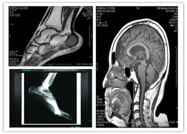 Good price แพทย์ฟิล์มสีฟ้าฐานแห้งถ่ายภาพ 8 x 10in เข้ากันได้ Hosipital Mri สแกน ออนไลน์