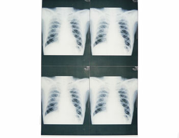 ฟิล์มสีขาวฐานแพทย์ X-ray กระดาษกันความชื้นสำหรับเครื่องพิมพ์เลเซอร์ Sony / EPSON