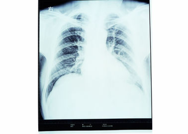 10 x 14 X-ray Medical Dry Imaging Film Sensitive Thermal สำหรับเครื่องพิมพ์ฟูจิ