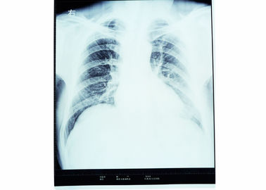 Good price X-ray ฟิล์มถ่ายภาพทางการแพทย์แห้งสำหรับ AGFA 5300/5302/5500 KND-A ออนไลน์