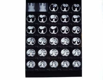 ฟิล์มเอ็กซ์เรย์ทางการแพทย์, ฟิล์มถ่ายภาพแห้งเข้ากันได้กับเครื่องพิมพ์ความร้อนสำหรับ CT / DR / MRI