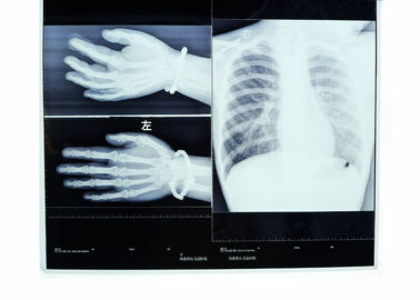 ฟิล์มเอ็กซ์เรย์แพทย์แห้งขนาด 10 x 14 นิ้วสำหรับฟูจิ 3000/2000/1000