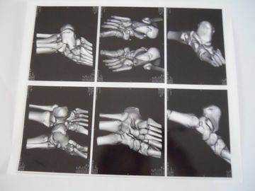 Good price ฟิล์มถ่ายภาพทางการแพทย์แห้งสำหรับการตรวจ X-ray บน AGFA 5300, 5302, 5500 ออนไลน์