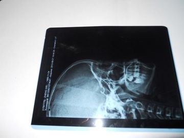 Good price ฟิล์มถ่ายภาพทางการแพทย์แห้งทางการแพทย์ KND-A สำหรับการตรวจ X-ray บน AGFA 5300 ออนไลน์